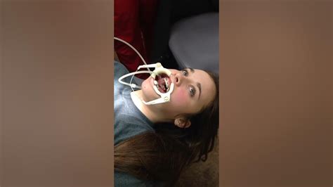 Sister Getting Braces Youtube