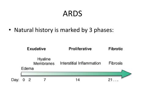 Ppt Ards Acute Respiratory Distress Syndrome Powerpoint