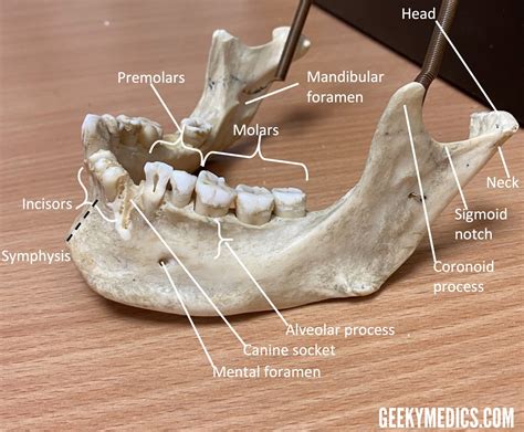 Mandibular Fractures Anatomy Management Geeky Medics