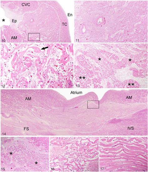 Histology of the sinoatrial node (SAN). H&E. Figure 10. Outline of the... | Download Scientific ...