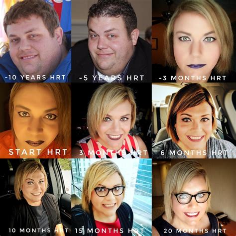 40 Yo Mtf Transition Timeline Lost 100lbs And Started Hrt At 39yo
