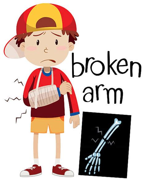 Best Broken Arm Illustrations Royalty Free Vector Graphics And Clip Art