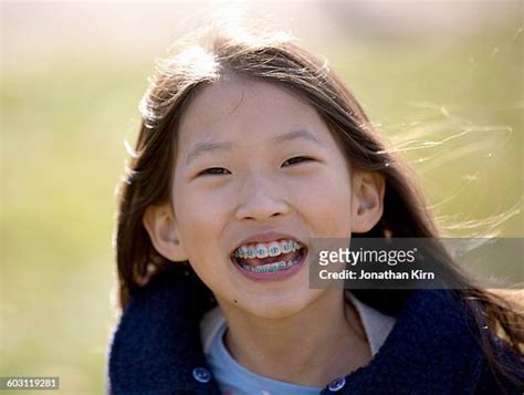 Asian Girl Braces Photos And Premium High Res Pictures Getty Images