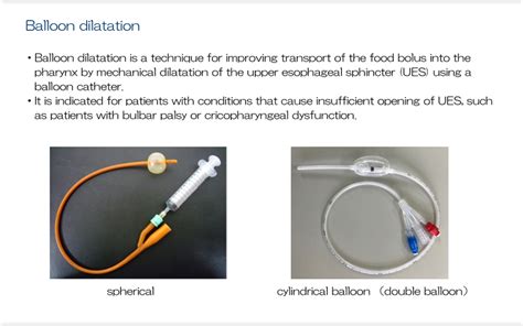 Indirect Training For The Pharyngeal Stage Balloon Dilation And Tube Swallowing Exercises