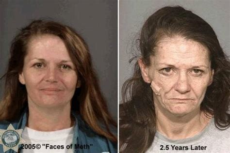 The Devastating Before And After Photos Of Crystal Meth Addiction Yourtango