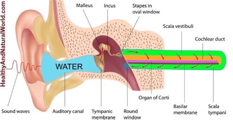 Let your doctor know immediately if dirty water enters. Best Ways to Get Water out of Ears: Naturally Unclog Your Ears