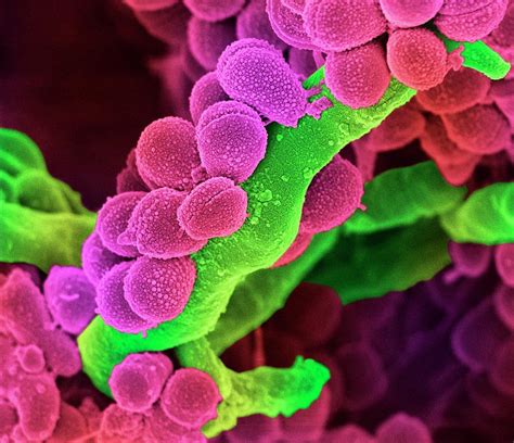 Streptococcus Bacteria Photograph By Science Photo Library