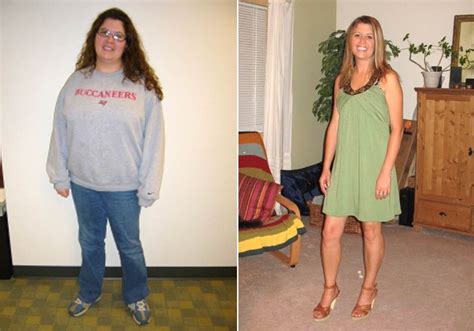 What Are The Common Questions Related To Bariatric Surgery Weight