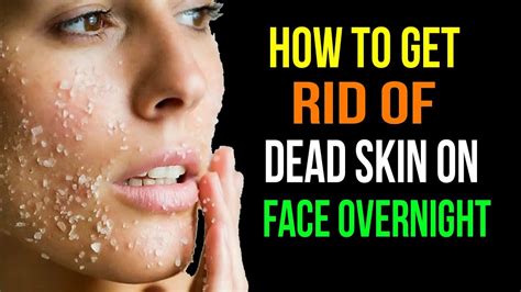 How To Get Rid Of Dead Skin On Face Overnight How To Remove Dead Skin
