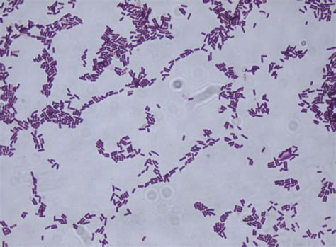 Bacillus Subtilis Under Microscope 100x Micropedia