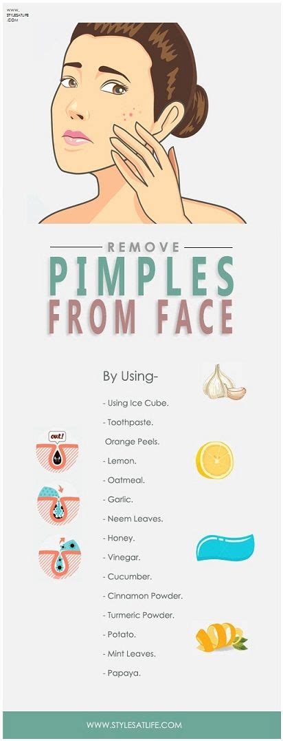 How To Remove Pimples Home Remedies And Prevention Tips How To Remove