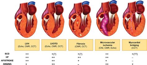 Role Of Multimodality Cardiac Imaging In The Management Of Patients
