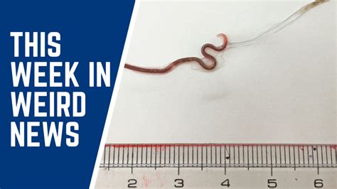 Doctors In Japan Remove Live Worm From Womans Tonsil And More Of This Weeks Weirdest News