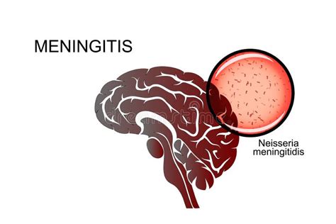 Meninges Of The Brain Stock Vector Illustration Of Frontal 19885574
