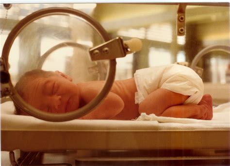 Preterm Newborn Rnpedia