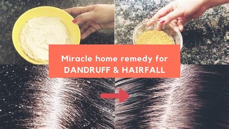 Miracle Cure For Dandruff And Hair Fall Magical Home Remedy To Treat