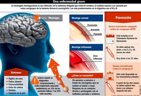 Qué Es La Meningitis Cómo Se Contagia Y Su Tratamiento Perfil