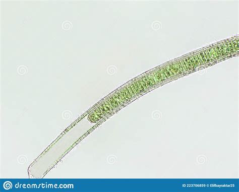 Oscillatoria Sp Algae Under Microscopic View X40 Stock Image Image