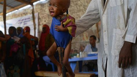 Unicef 14 Millionen Kinder In Afrika Vom Hungertod Bedroht