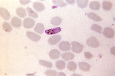 Free Picture Micrograph Reddish Colored Plasmodium Falciparum
