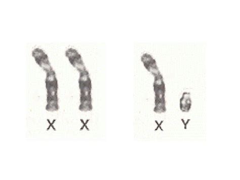 Sex Chromosomes And Abnormalities Sex Chromosomes At The