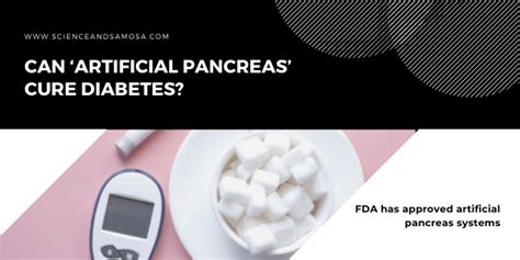 Can ‘artificial Pancreas Cure Diabetes