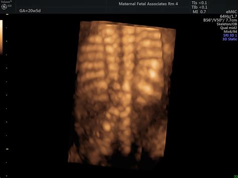 Anatomy Ultrasound Maternal Fetal Associates Of The Mid Atlantic