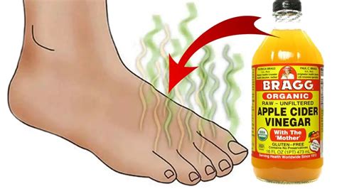 How To Easily Get Rid Of Smelly Feet With Apple Cider Vinegar Epic