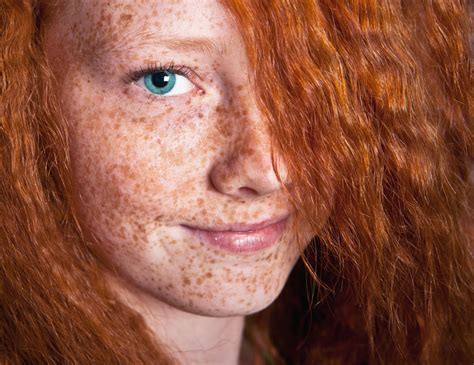 What Is The Difference Between Age Spots Sun Spots And Freckles — Moyal Therapies