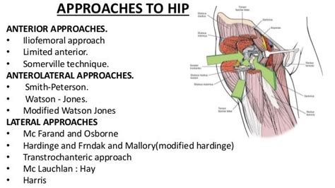 Hip Anatomy Approaches And Avn