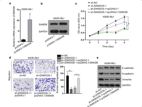 DNM3OS Positively Regulate Cell Proliferation Migration And EMT Of RB