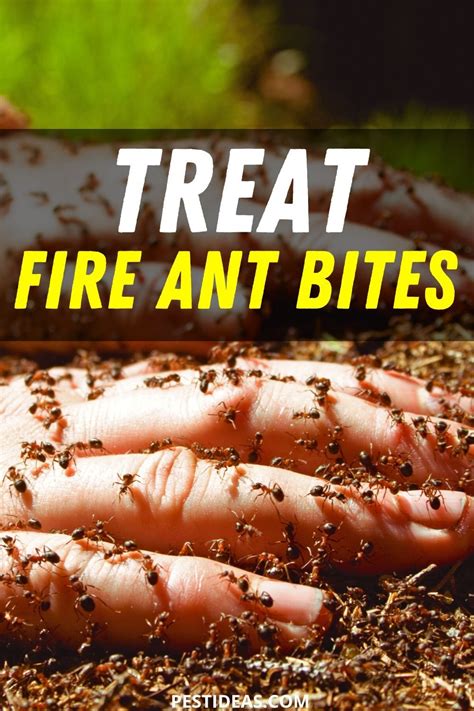 Natural Remedies For Soothing Fire Ant Bites