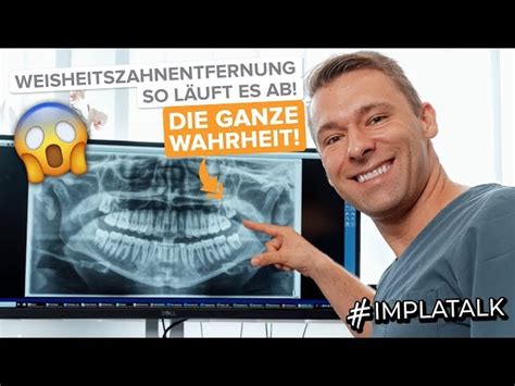 Werden sie aber von krankheitserregern überrannt, zum beispiel weil heute ist man insbesondere bei kindern, aber auch bei erwachsenen, bei der entscheidung für einen eingriff sehr viel zurückhaltender. Schonende Entfernung von Weisheitszähnen - ZahnZentrum ...