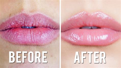 Chapped Lips Remedy Chapped Lips Remedy Cure For Chapped Lips Lip