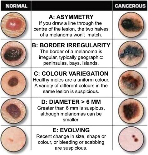 Full Body Skin Exam — The Center For Excellence In Dermatology