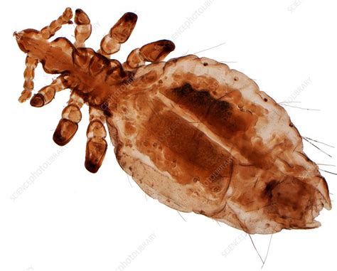 Human Head Louse Lm Stock Image F0166179 Science Photo Library