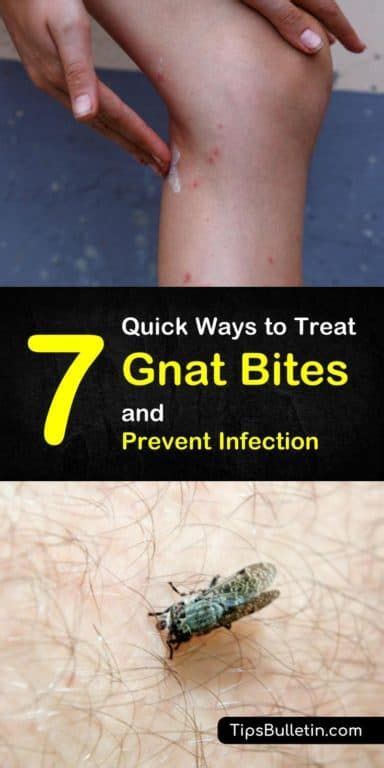 7 Quick Ways To Treat Gnat Bites And Prevent Infection Gnat Bites