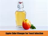 Vinegar Home Remedies For Yeast Infection