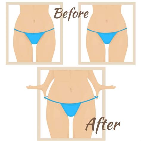 What Is Bikini Waxing 13 Tips To Keep In Mind Before You Plan Your First Bikini Waxing