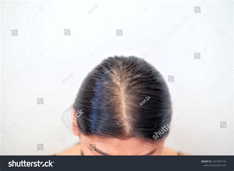 Women Thin Hair There Pulses Hair Stock Photo 1627467718 Shutterstock