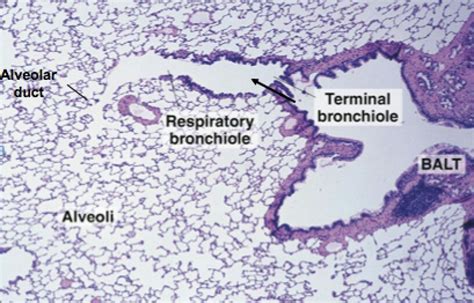 Terminal Bronchioles Leading To Alveolar Ducts Respiratory System