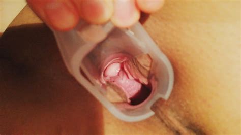 Speculum Vaginal Close Up By Putaranka Model Xhamster Premium