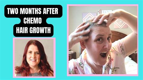 Months After Chemotherapy Hair Growth Breast Cancer Stage A Hair Growth After Chemo YouTube