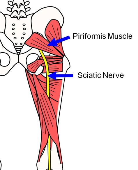 Muscle Tightness Piriformis Muscle Tightness Pain