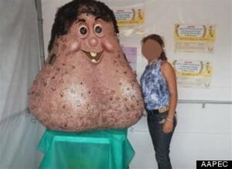 Mr Balls Brazilian Cancer Mascot Is A Pair Of Testicles
