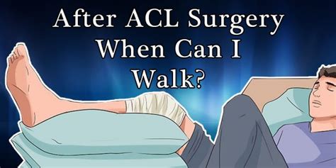 After Acl Surgery When Can I Walk 10 Key Tips And 4 Stages To Progress