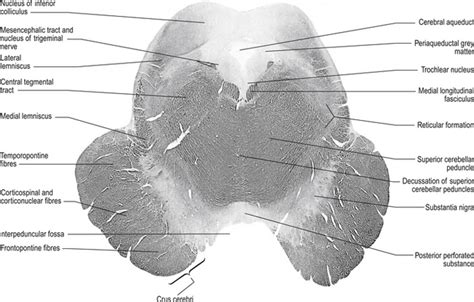The Brainstem And Reticular Formation Neupsy Key