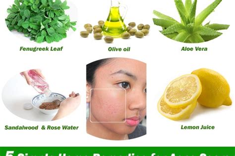 We at extrachai have curated a list of home remedies for acne scars that will definitely ease the vanishing process. Five simple and effective home remedies for acne scars ...
