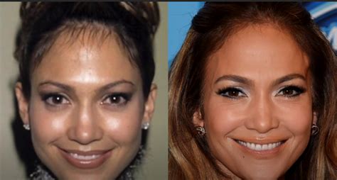 Is Jennifer Lopez Plastic Surgery Rumors True Plastic Surgery Magazine