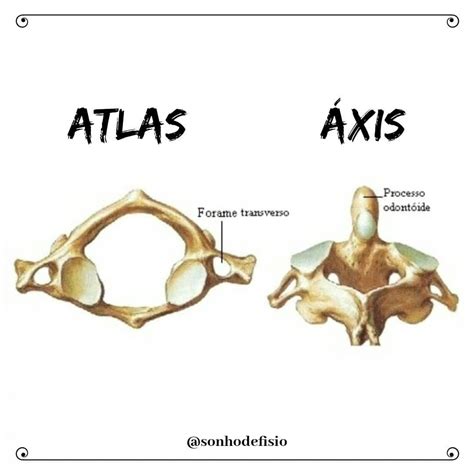 Vertebras Cervicais Atlas E Axis